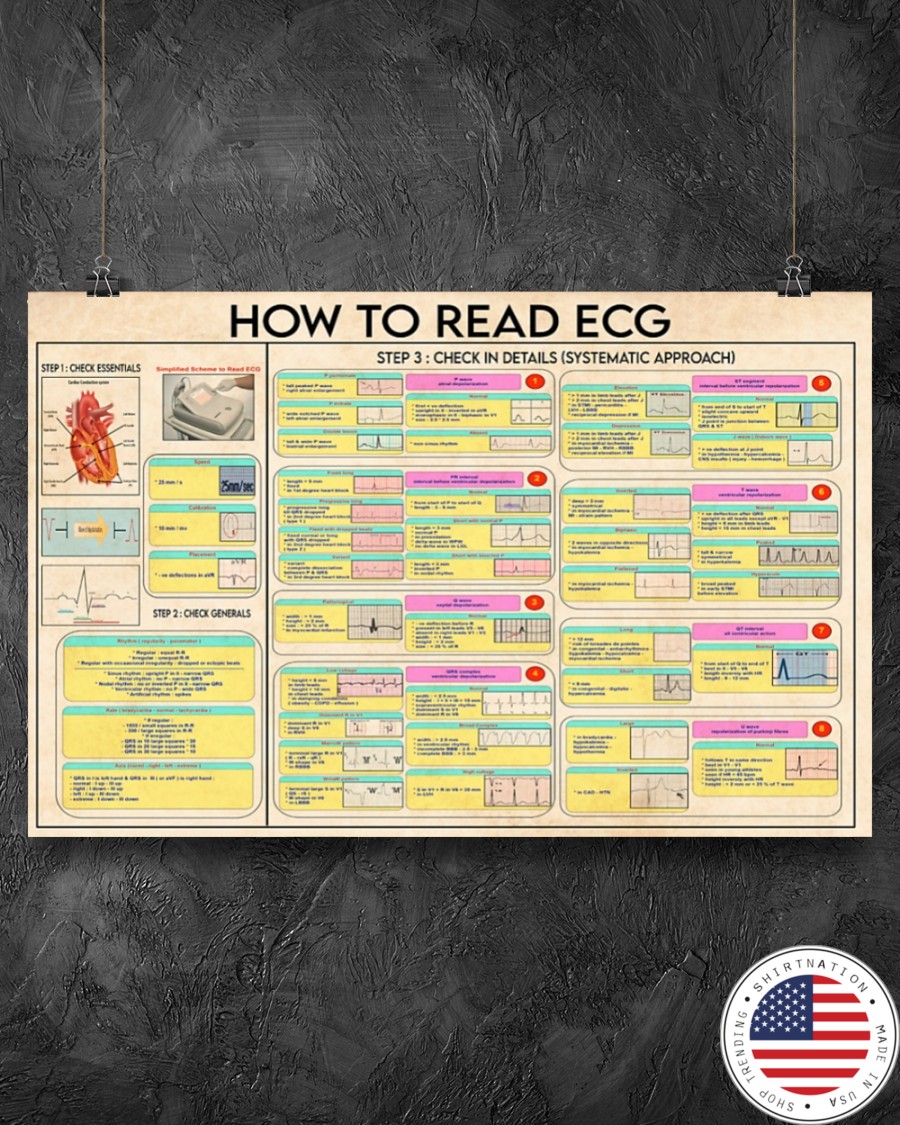 Cardiologist how to read ecg poster