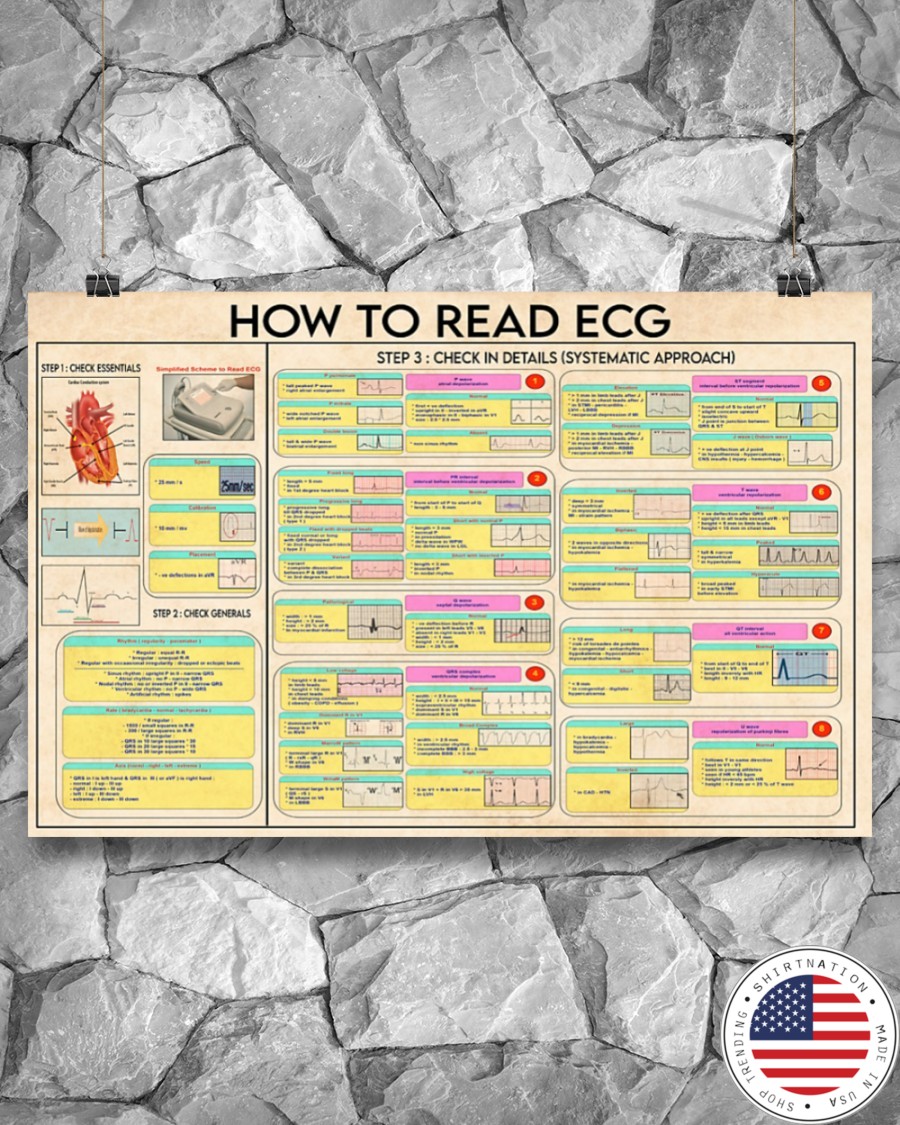 Cardiologist how to read ecg poster