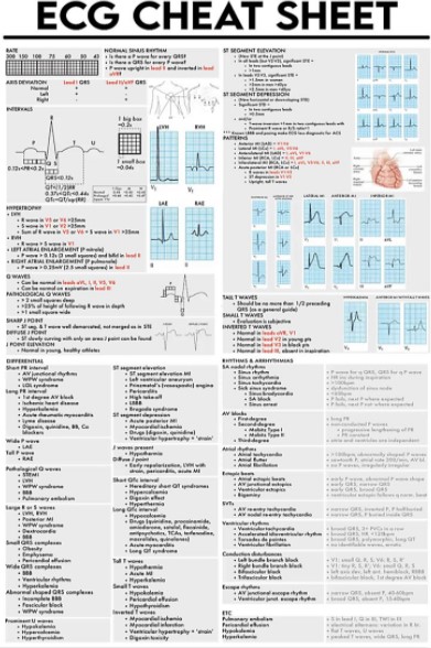 ECG cheat sheet poster